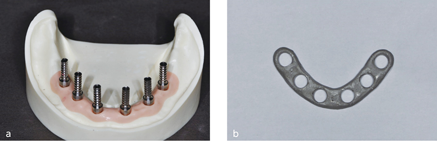 Fig.2