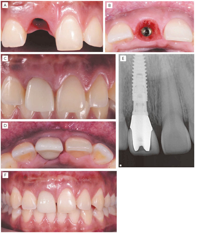 Fig. 5