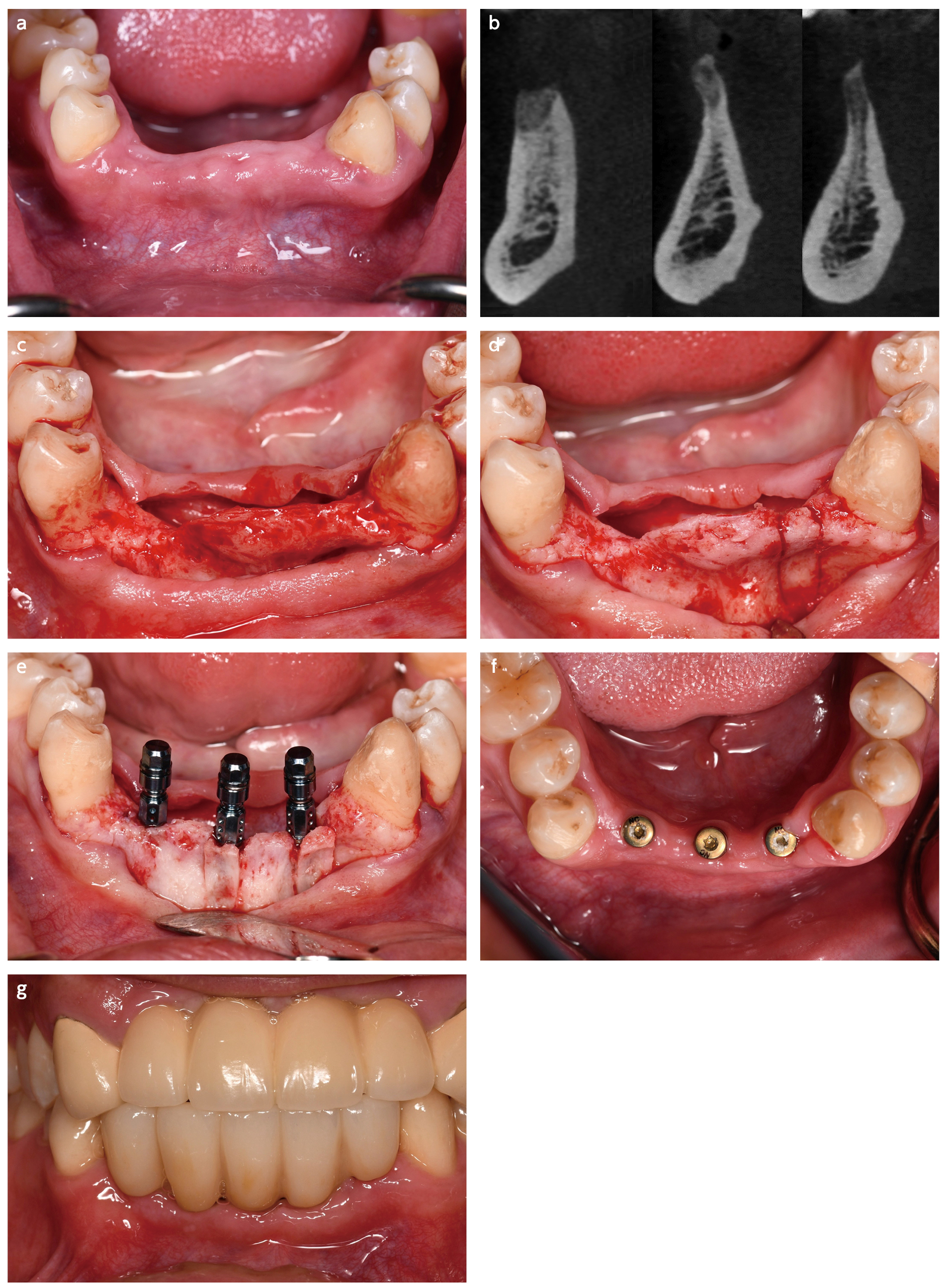 Fig 6