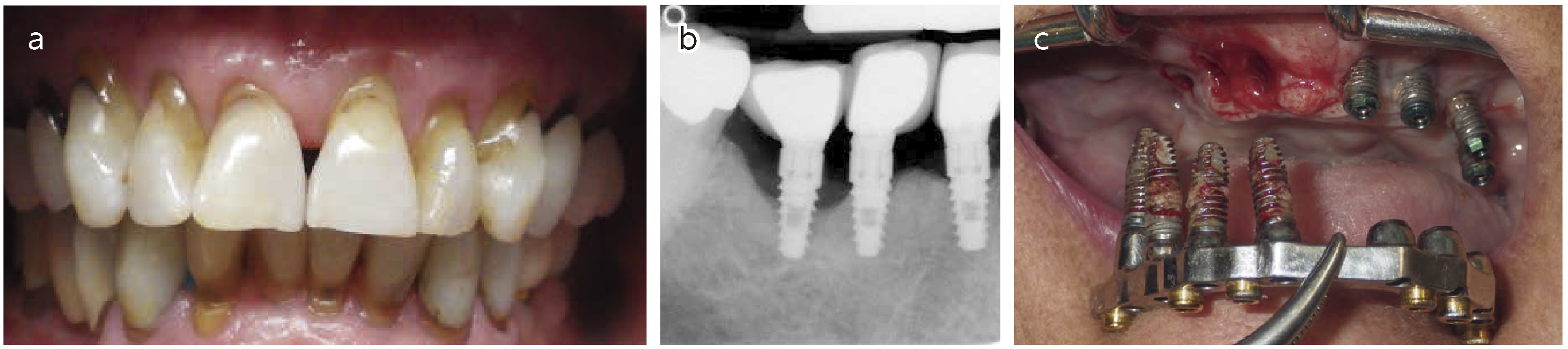 Fig 3