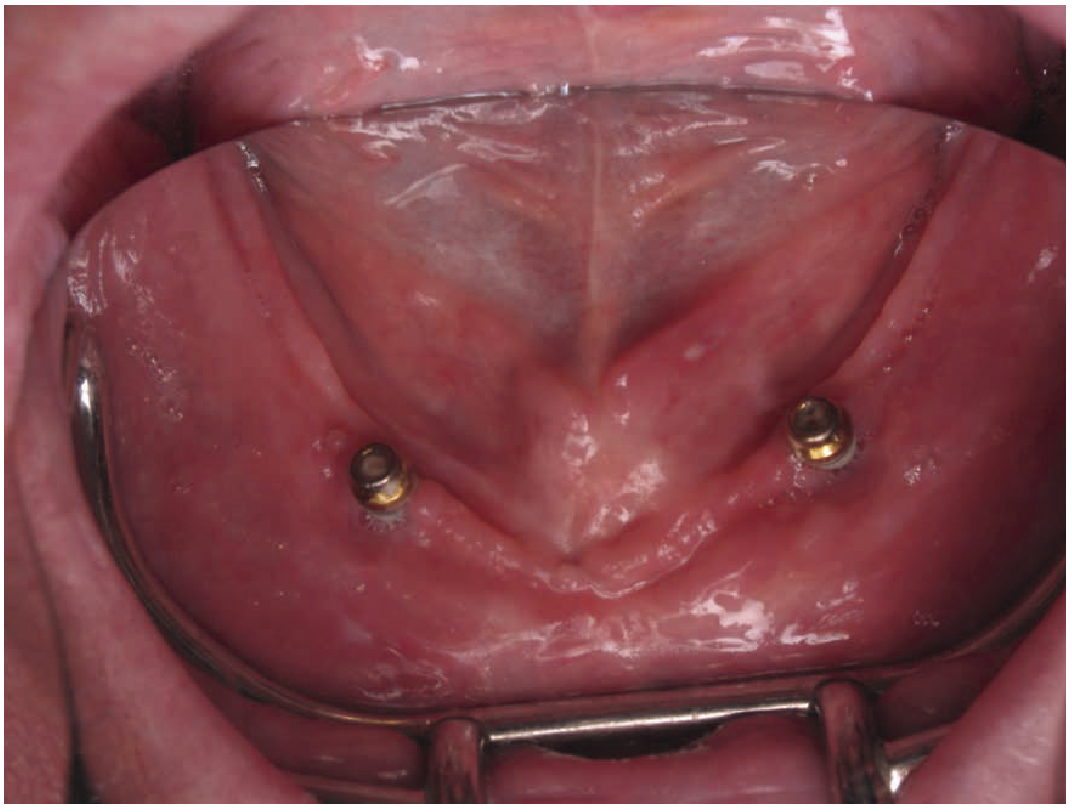 Fig 2